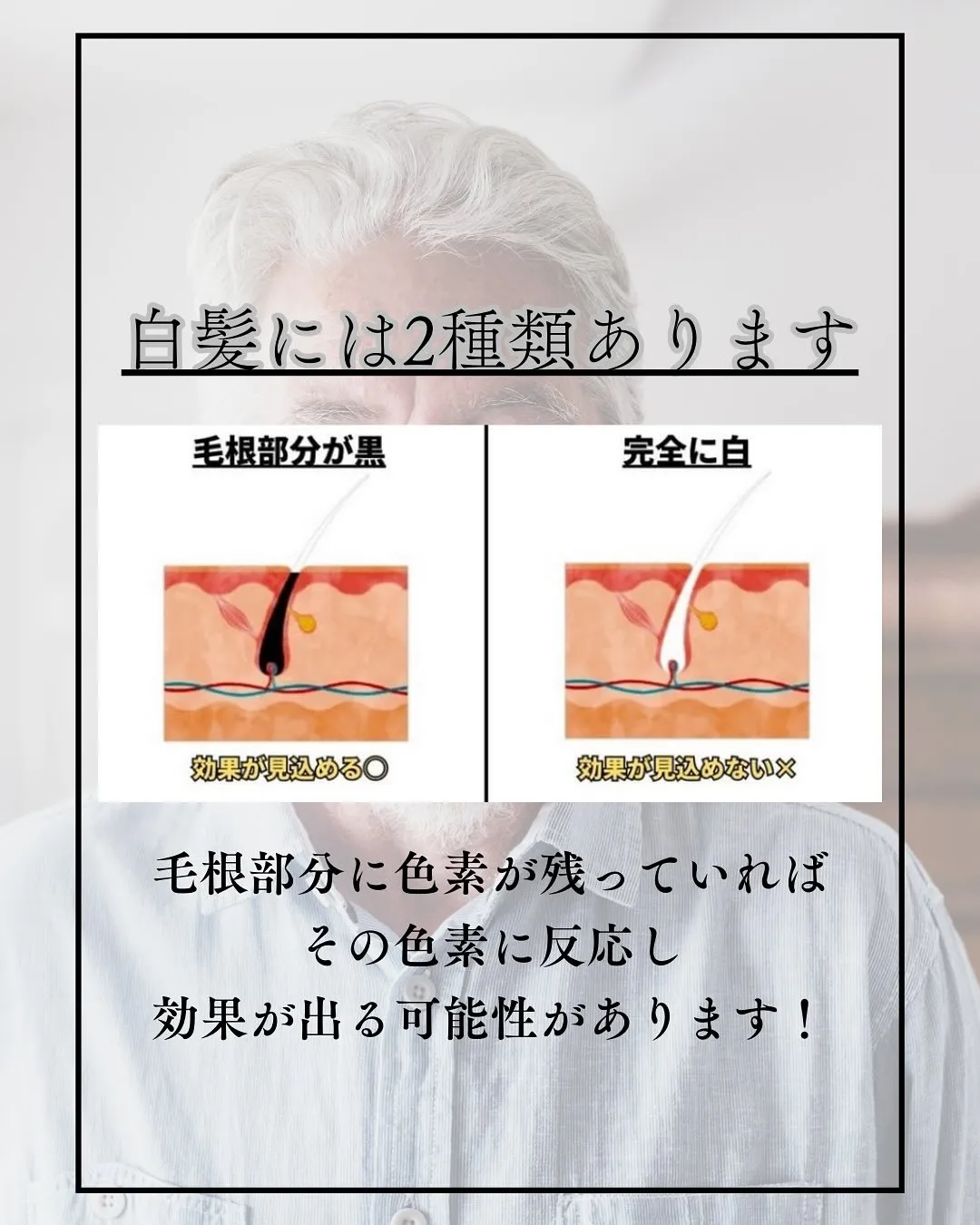 白髪に脱毛効果がない⁉️