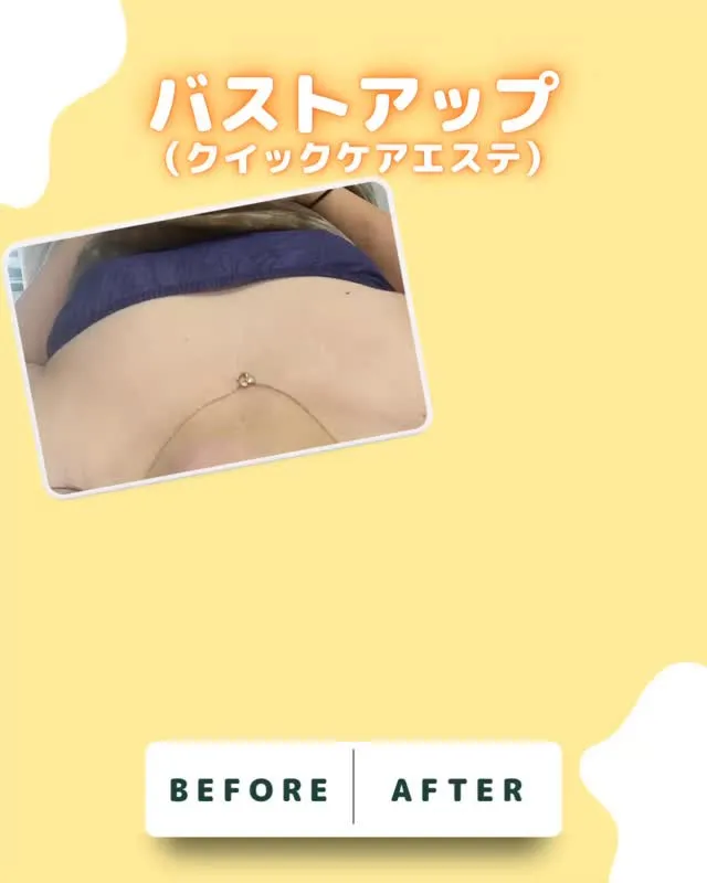 Clear Canvasの【クイックリフトバスト】